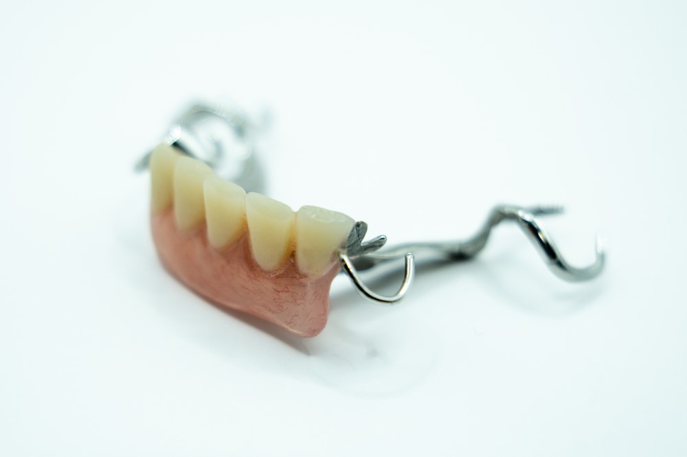 口腔内の環境は大切