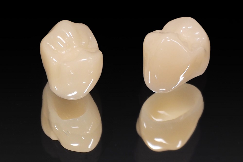 硬質レジン前装冠